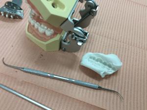 模型の歯形.JPG